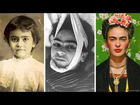 La Tragica Storia di Frida Kahlo